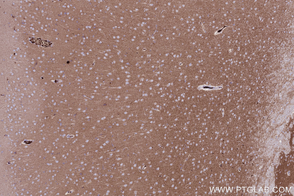 Immunohistochemistry (IHC) staining of rat brain tissue using NLGN1 Monoclonal antibody (66964-1-Ig)