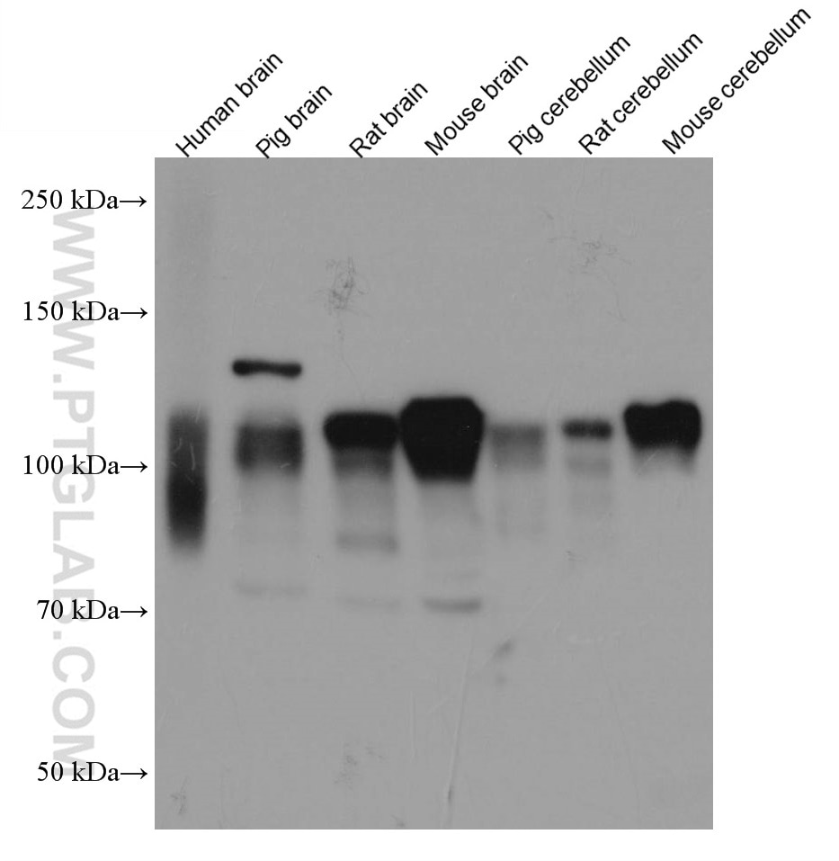 Western Blot (WB) analysis of various lysates using NLGN1 Monoclonal antibody (66964-1-Ig)