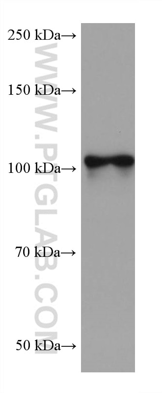 Western Blot (WB) analysis of rat brain tissue using NLGN1 Monoclonal antibody (66964-1-Ig)