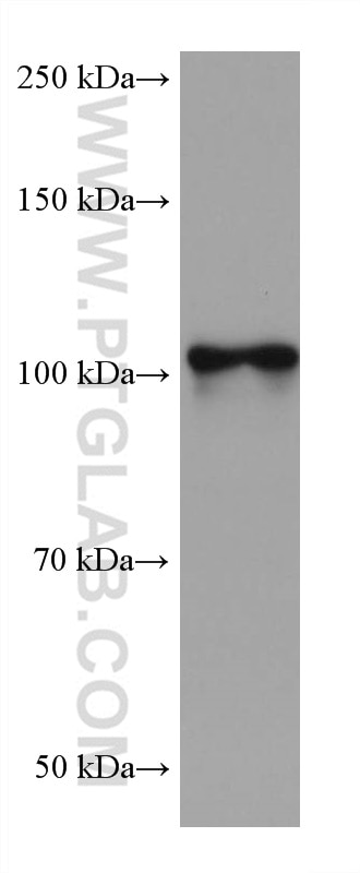 WB analysis of rat brain using 66964-1-Ig