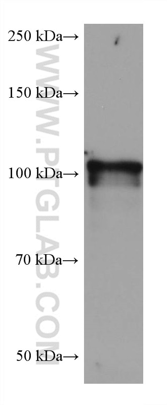 Western Blot (WB) analysis of rabbit brain tissue using NLGN1 Monoclonal antibody (66964-1-Ig)