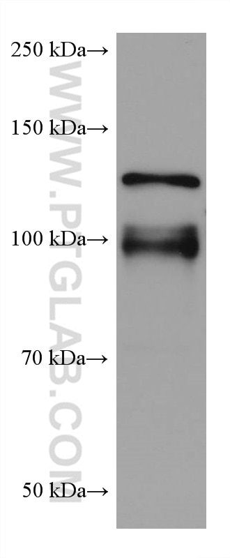 Western Blot (WB) analysis of pig brain tissue using NLGN1 Monoclonal antibody (66964-1-Ig)