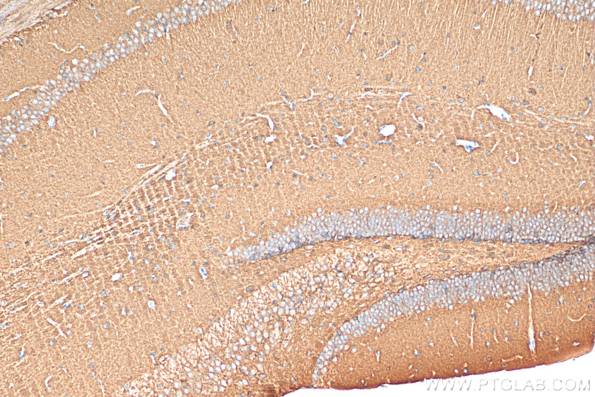 Immunohistochemistry (IHC) staining of mouse brain tissue using NLGN3 Polyclonal antibody (29319-1-AP)