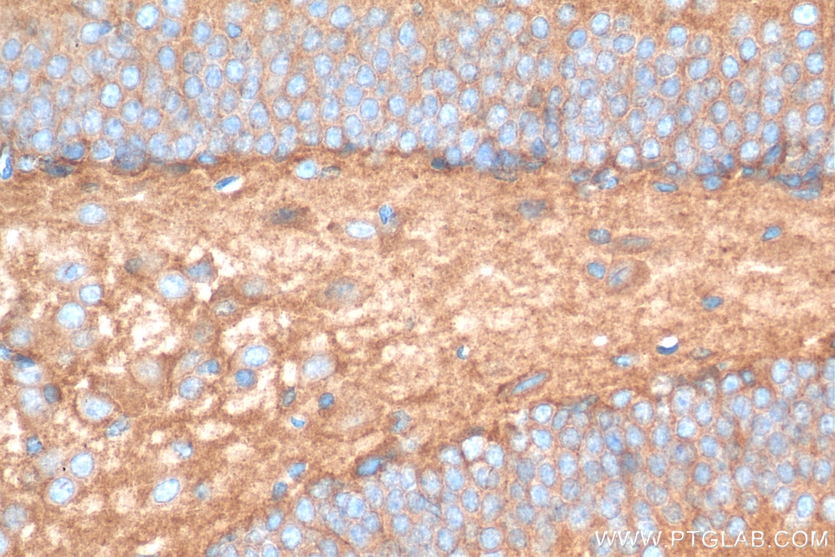 Immunohistochemistry (IHC) staining of mouse brain tissue using NLGN3 Polyclonal antibody (29319-1-AP)