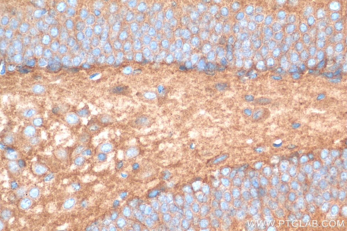 Immunohistochemistry (IHC) staining of mouse brain tissue using NLGN3 Polyclonal antibody (29319-1-AP)