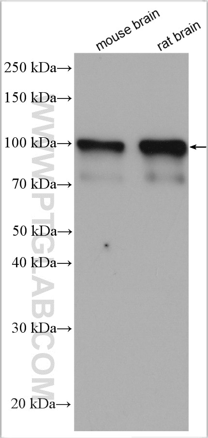 Western Blot (WB) analysis of various lysates using NLGN3 Polyclonal antibody (29319-1-AP)
