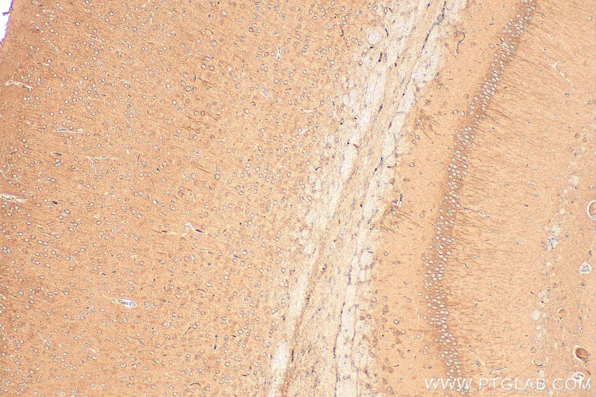 Immunohistochemistry (IHC) staining of mouse brain tissue using NLGN4X Polyclonal antibody (27278-1-AP)