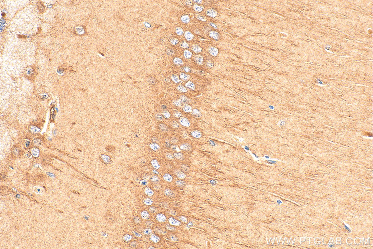 Immunohistochemistry (IHC) staining of mouse brain tissue using NLGN4X Polyclonal antibody (27278-1-AP)