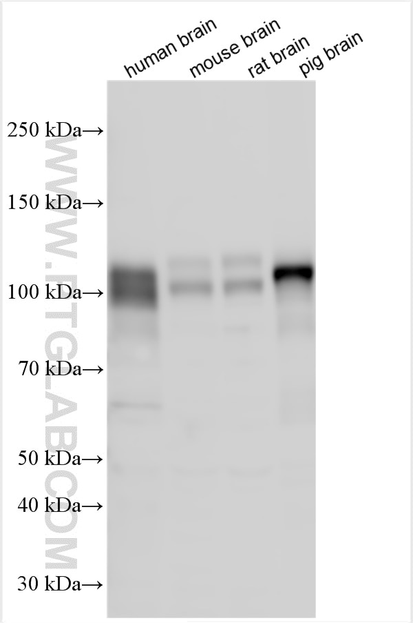 Western Blot (WB) analysis of various lysates using NLGN4X Polyclonal antibody (27278-1-AP)