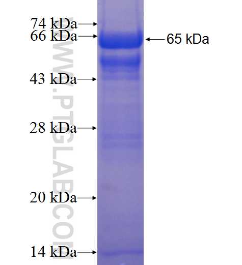 NLK fusion protein Ag5750 SDS-PAGE