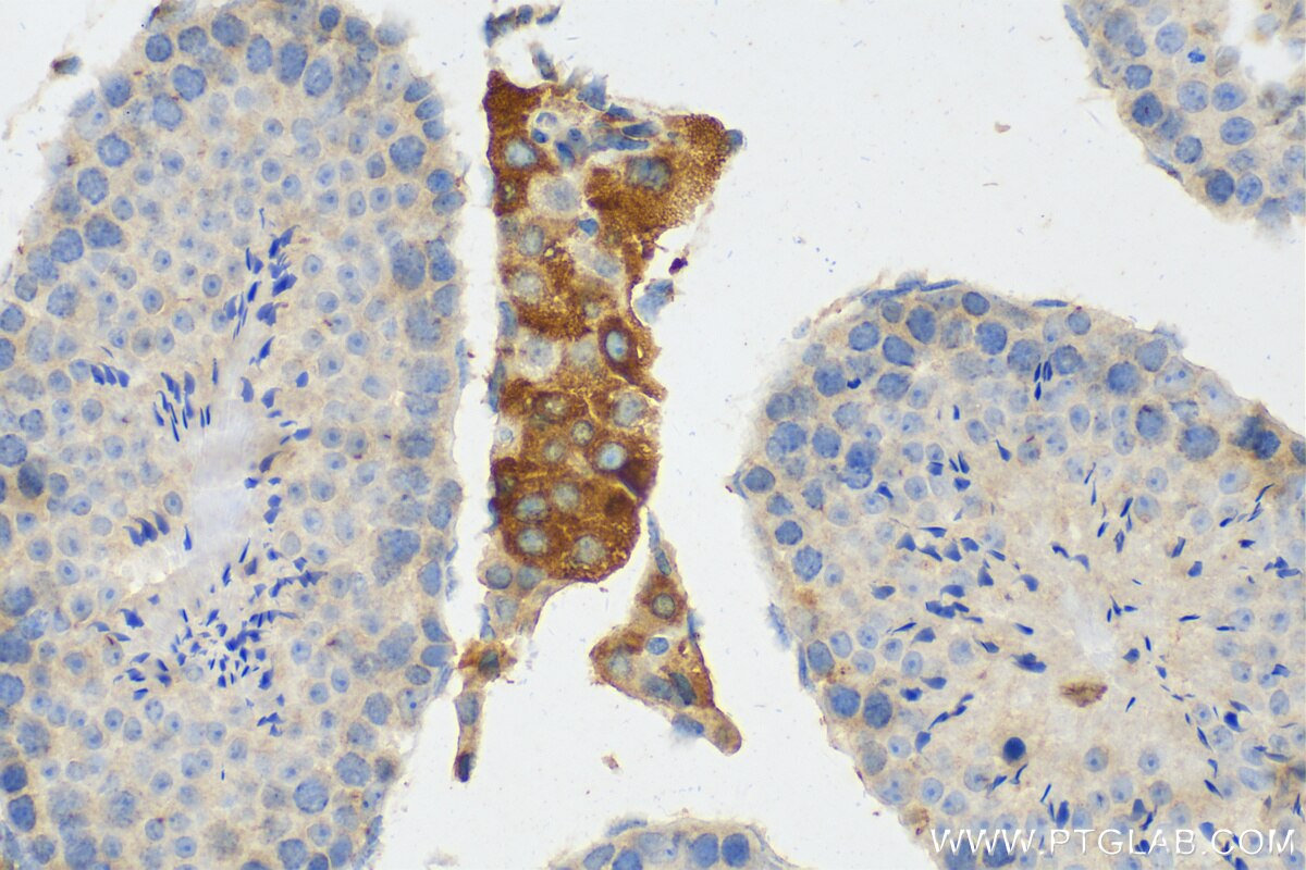 Immunohistochemistry (IHC) staining of mouse testis tissue using NLN Polyclonal antibody (14763-1-AP)