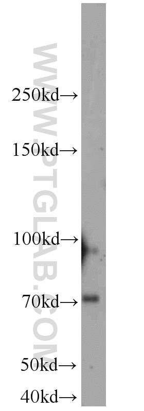 Western Blot (WB) analysis of HepG2 cells using NLN Polyclonal antibody (14763-1-AP)