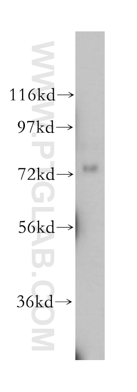 Western Blot (WB) analysis of mouse ovary tissue using NLN Polyclonal antibody (14763-1-AP)