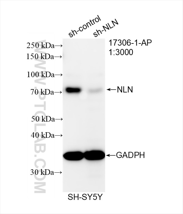 Western Blot (WB) analysis of SH-SY5Y cells using NLN Polyclonal antibody (17306-1-AP)