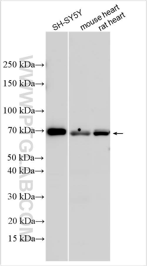 Western Blot (WB) analysis of various lysates using NLN Polyclonal antibody (17306-1-AP)