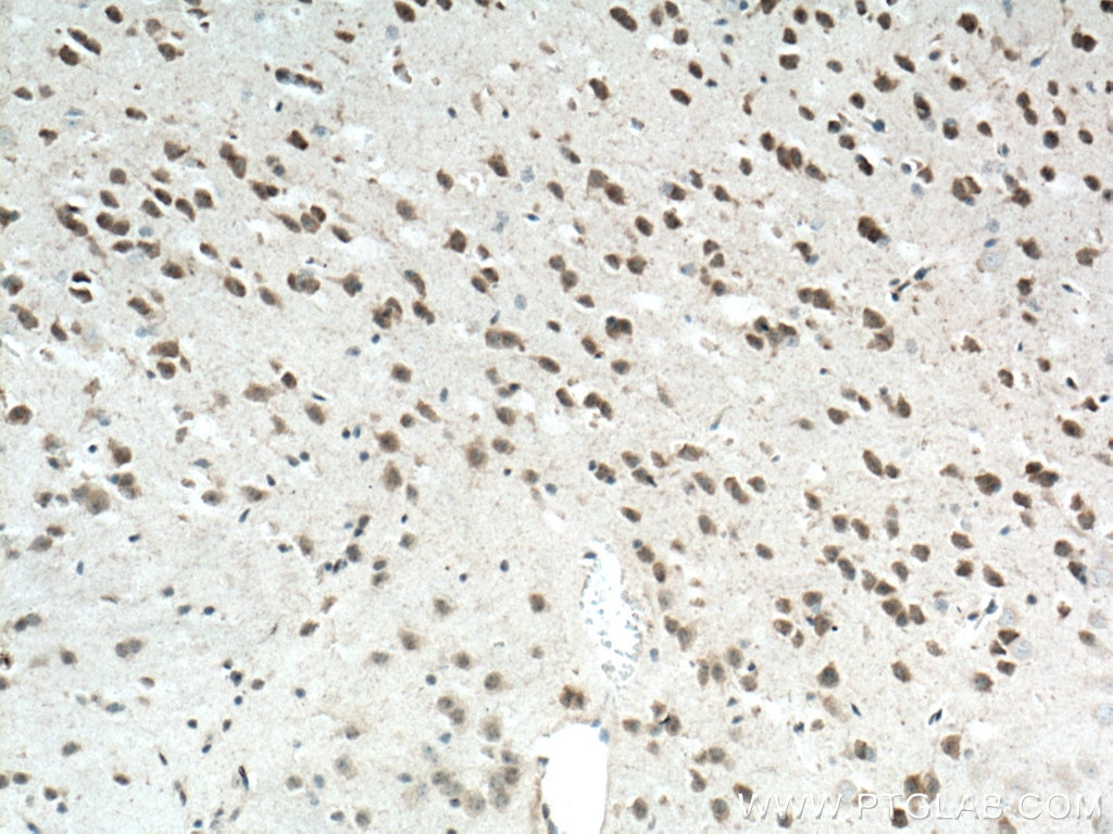 Immunohistochemistry (IHC) staining of mouse brain tissue using NLRP1 Polyclonal antibody (12256-1-AP)