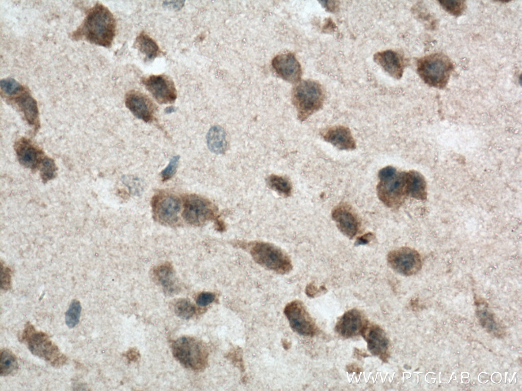 Immunohistochemistry (IHC) staining of mouse brain tissue using NLRP1 Polyclonal antibody (12256-1-AP)
