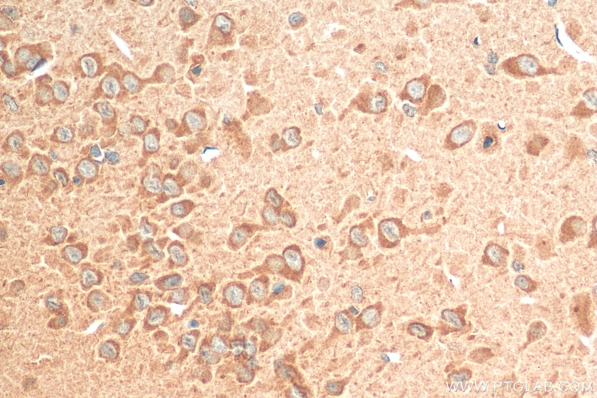 Immunohistochemistry (IHC) staining of rat brain tissue using NLRP1 Polyclonal antibody (12256-1-AP)