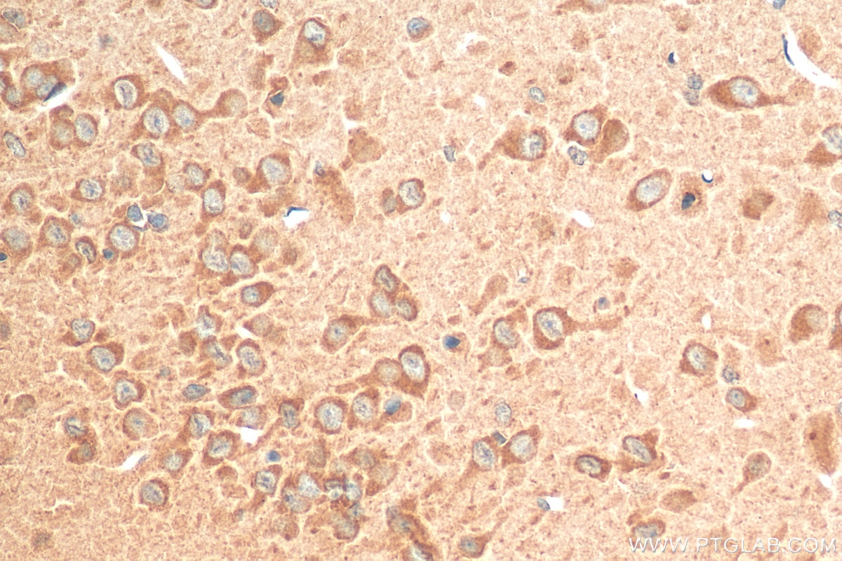 IHC staining of rat brain using 12256-1-AP