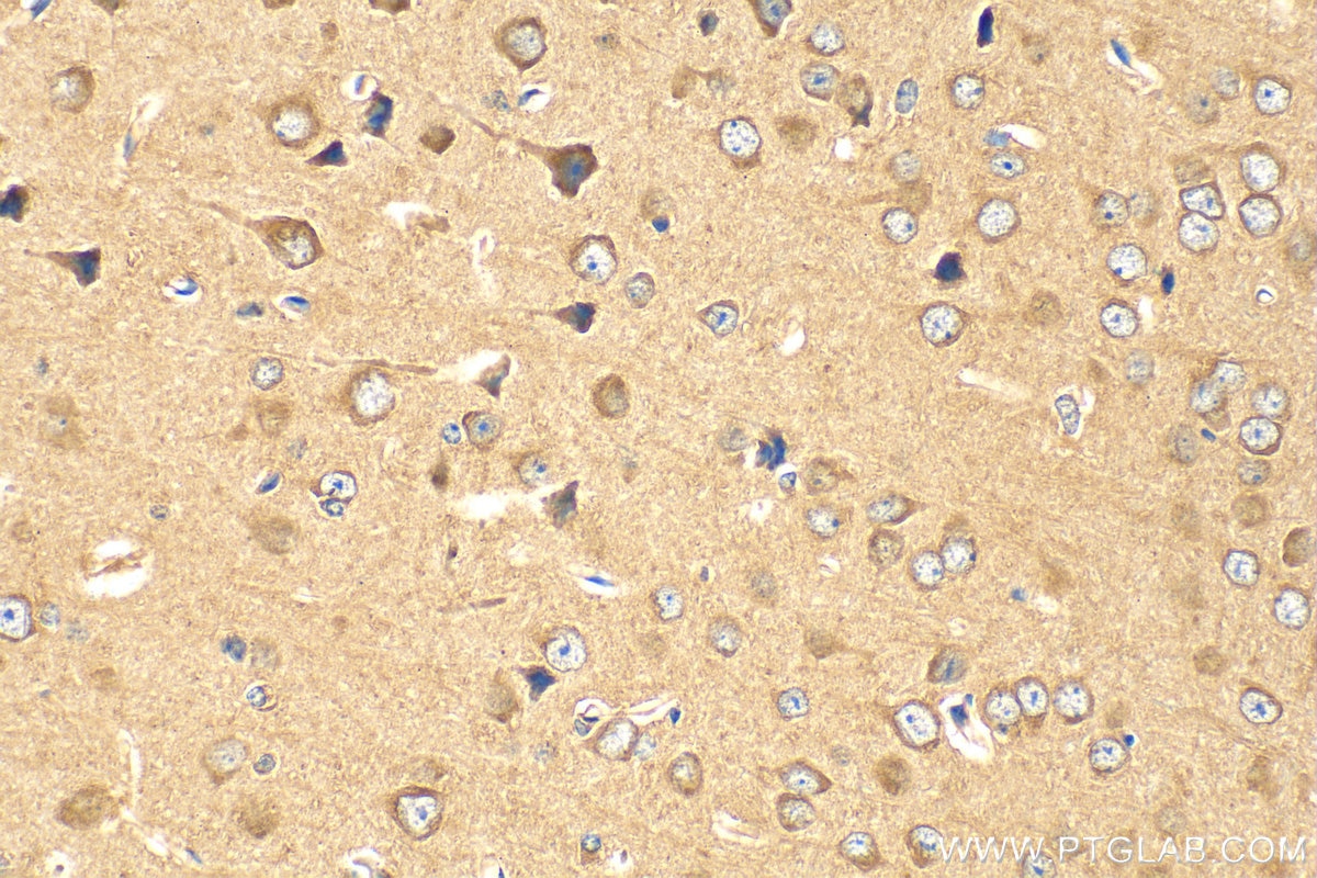 Immunohistochemistry (IHC) staining of mouse brain tissue using NLRP1 Polyclonal antibody (12256-1-AP)