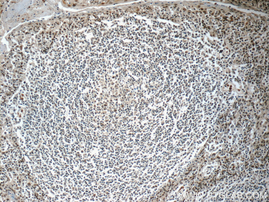 NLRP1 Polyclonal antibody