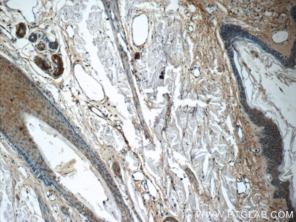 Immunohistochemistry (IHC) staining of human skin tissue using NLRP10 Polyclonal antibody (24924-1-AP)