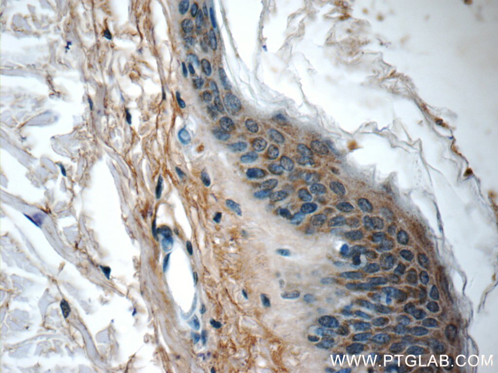 Immunohistochemistry (IHC) staining of human skin tissue using NLRP10 Polyclonal antibody (24924-1-AP)