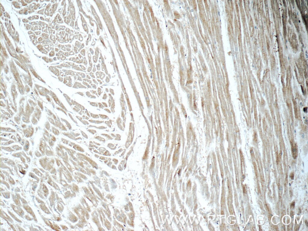 Immunohistochemistry (IHC) staining of human heart tissue using NLRP10 Polyclonal antibody (24924-1-AP)