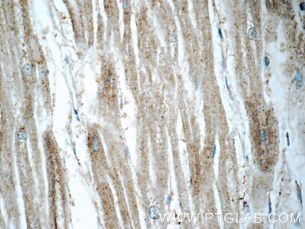 Immunohistochemistry (IHC) staining of human heart tissue using NLRP10 Polyclonal antibody (24924-1-AP)