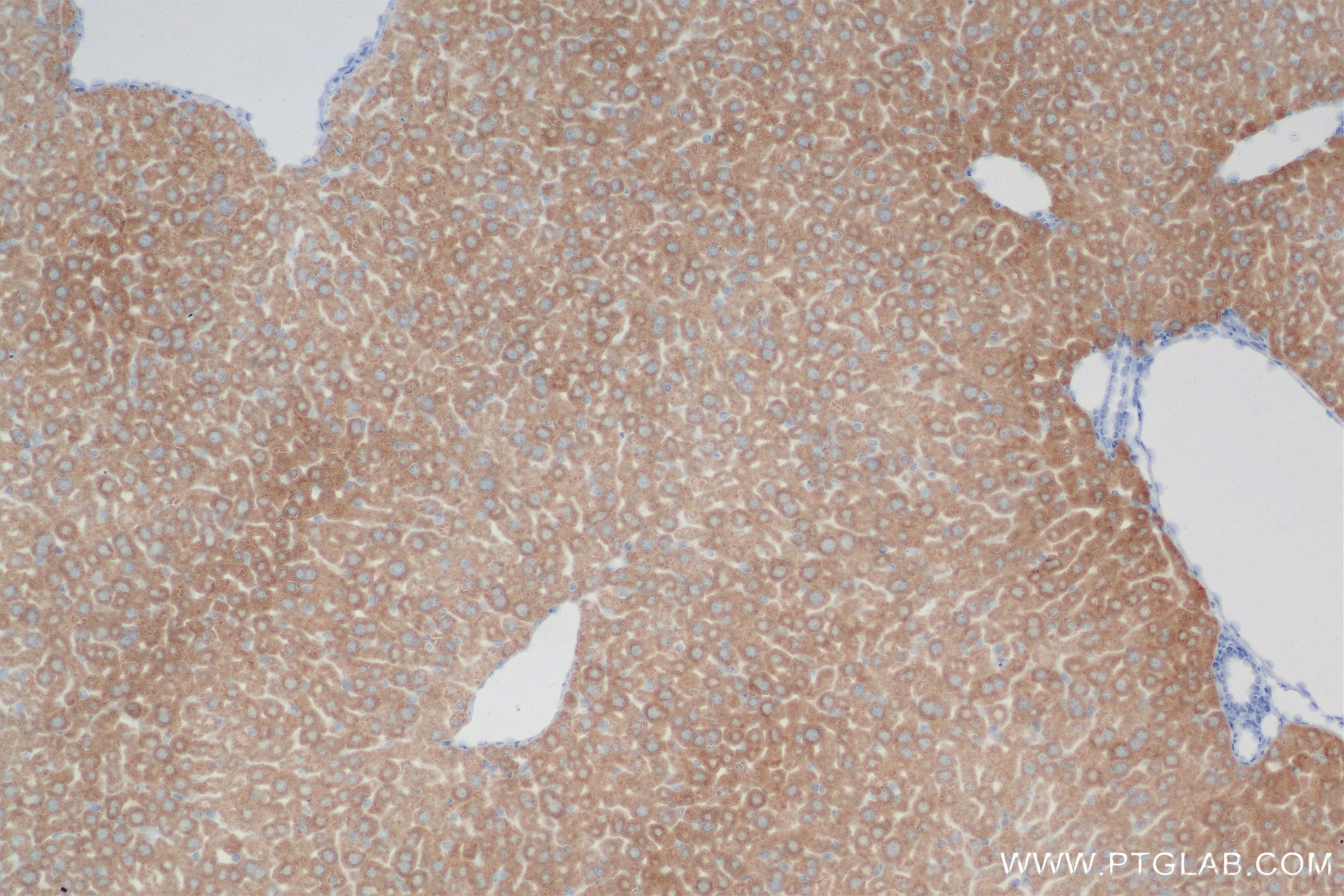 Immunohistochemistry (IHC) staining of mouse liver tissue using NLRP12 Recombinant antibody (83123-6-RR)