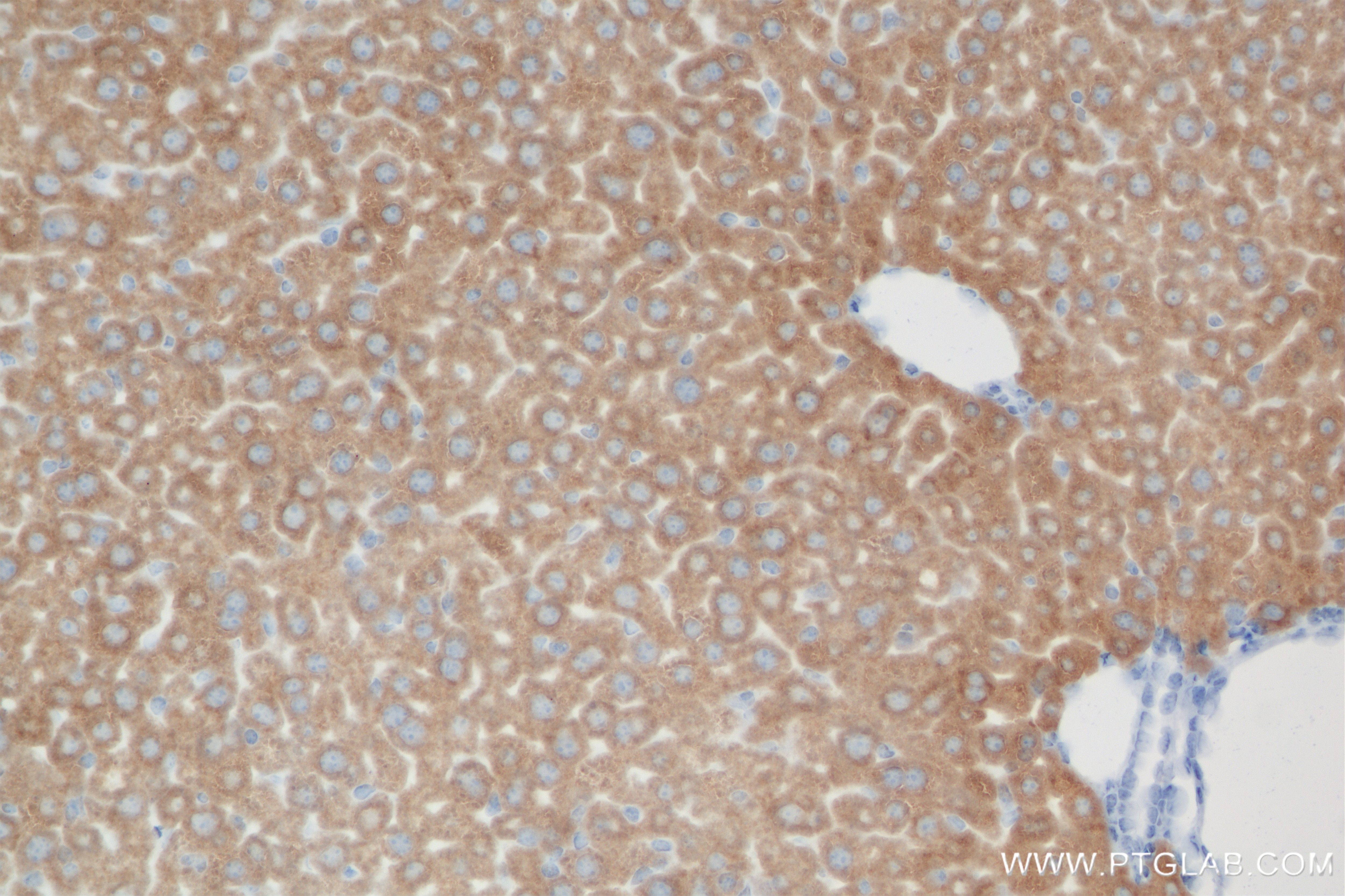 Immunohistochemistry (IHC) staining of mouse liver tissue using NLRP12 Recombinant antibody (83123-6-RR)