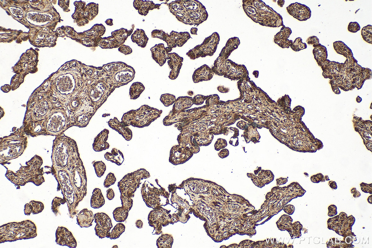 Immunohistochemistry (IHC) staining of human placenta tissue using NLRP2 Polyclonal antibody (15182-1-AP)