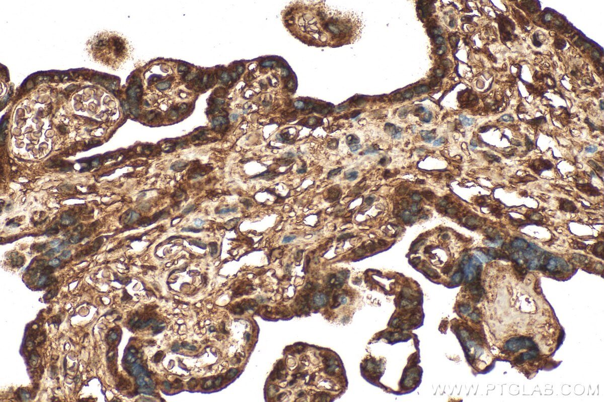 Immunohistochemistry (IHC) staining of human placenta tissue using NLRP2 Polyclonal antibody (15182-1-AP)