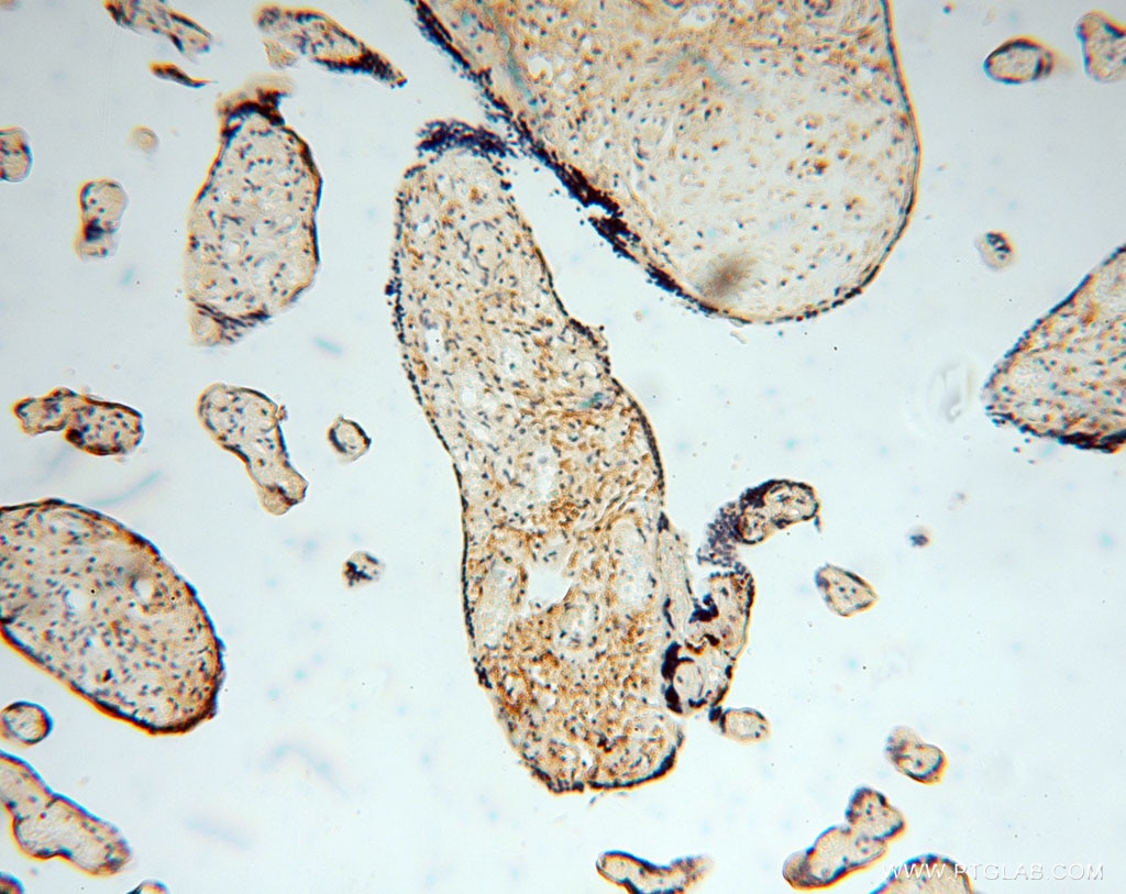 Immunohistochemistry (IHC) staining of human placenta tissue using NLRP2 Polyclonal antibody (15182-1-AP)