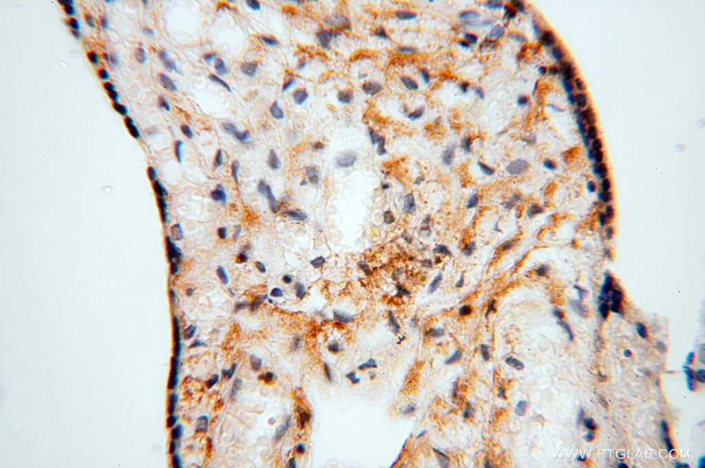 Immunohistochemistry (IHC) staining of human placenta tissue using NLRP2 Polyclonal antibody (15182-1-AP)