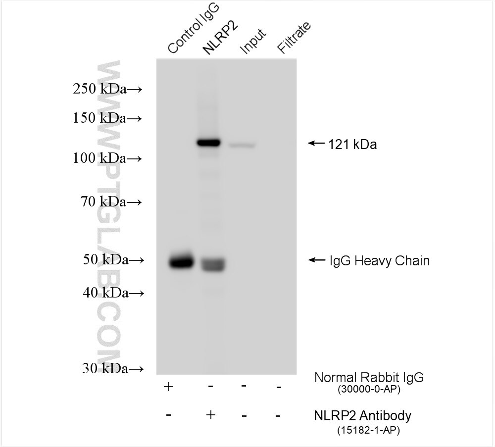 Immunoprecipitation (IP) experiment of A549 cells using NLRP2 Polyclonal antibody (15182-1-AP)