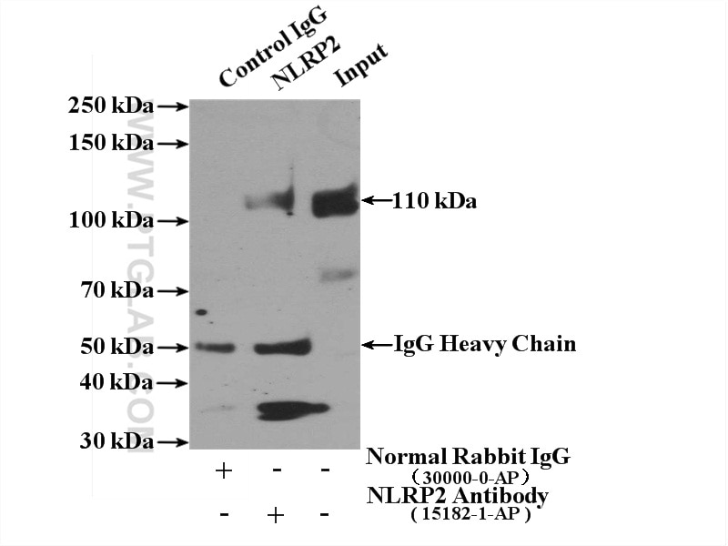 Immunoprecipitation (IP) experiment of A549 cells using NLRP2 Polyclonal antibody (15182-1-AP)