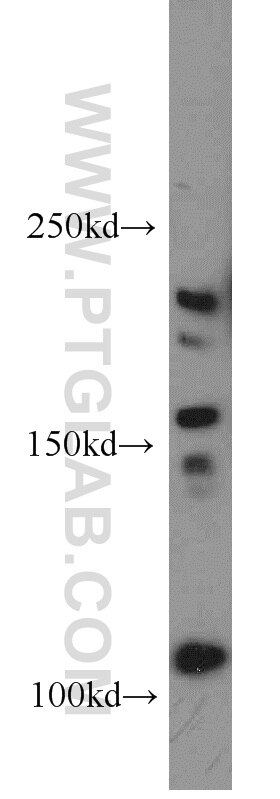 Western Blot (WB) analysis of mouse lung tissue using NLRP2 Polyclonal antibody (15182-1-AP)