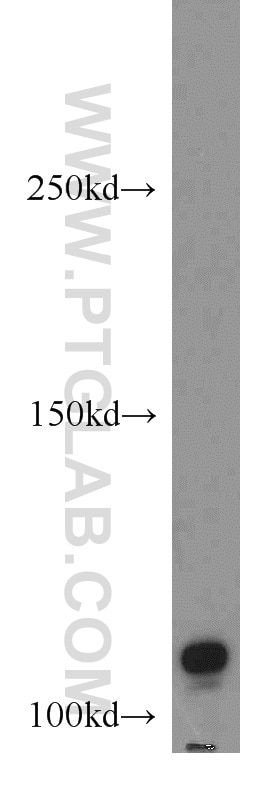 Western Blot (WB) analysis of A549 cells using NLRP2 Polyclonal antibody (15182-1-AP)