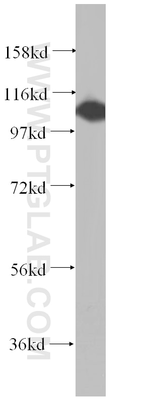 Western Blot (WB) analysis of human lung tissue using NLRP2 Polyclonal antibody (15182-1-AP)