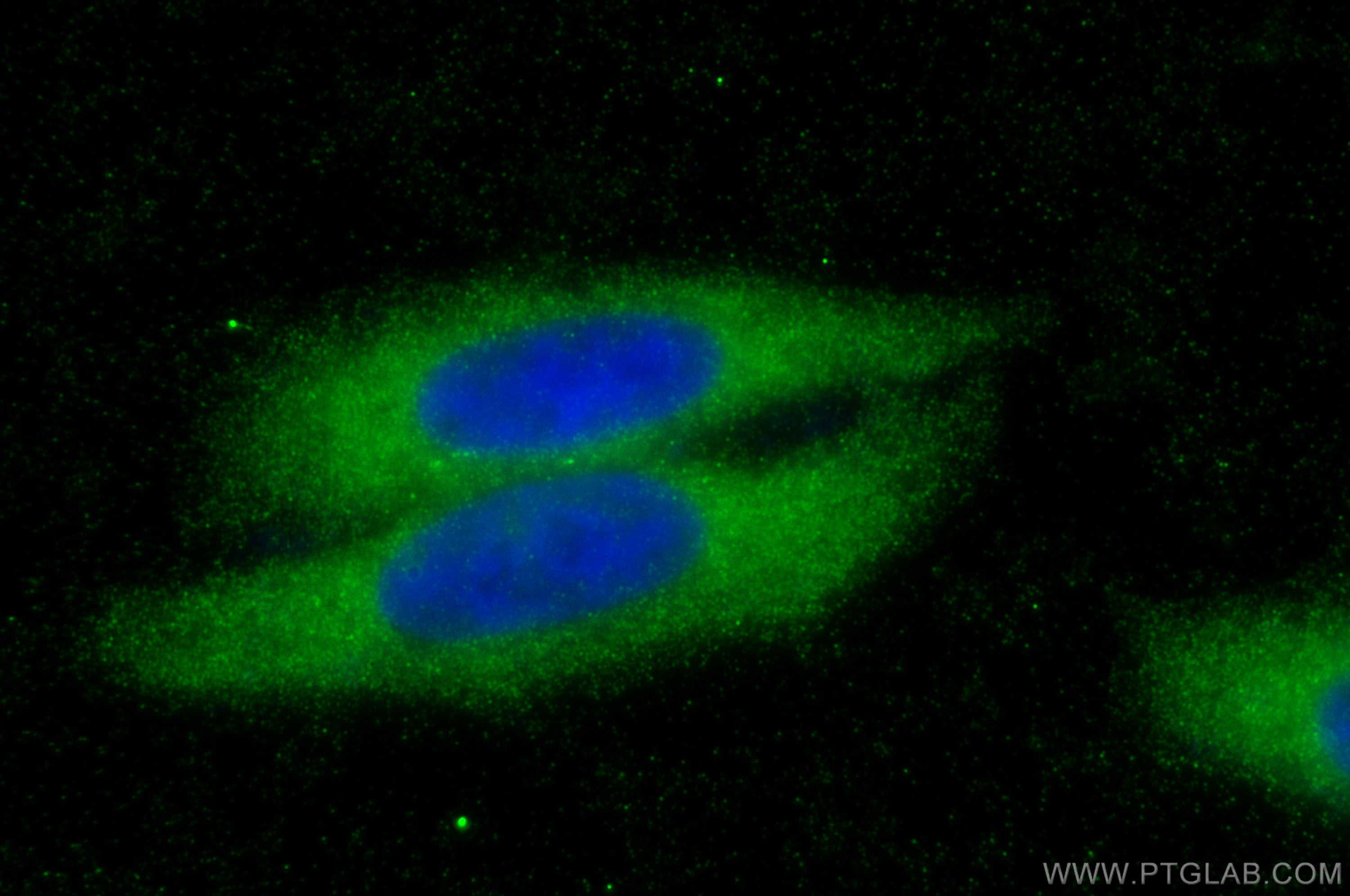 Immunofluorescence (IF) / fluorescent staining of HepG2 cells using NLRP3 Polyclonal antibody (27458-1-AP)
