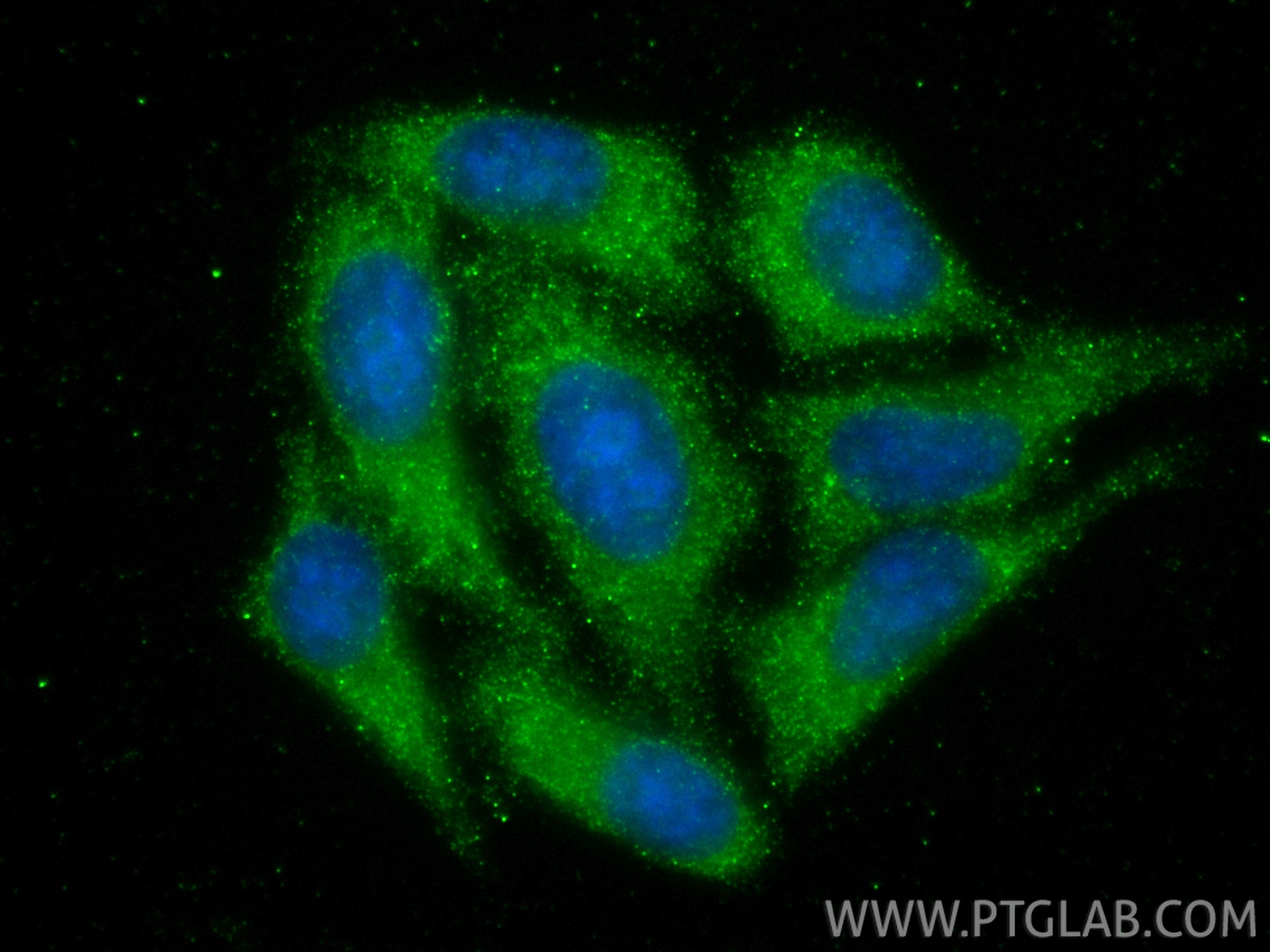 Immunofluorescence (IF) / fluorescent staining of HepG2 cells using NLRP3 Monoclonal antibody (68102-1-Ig)