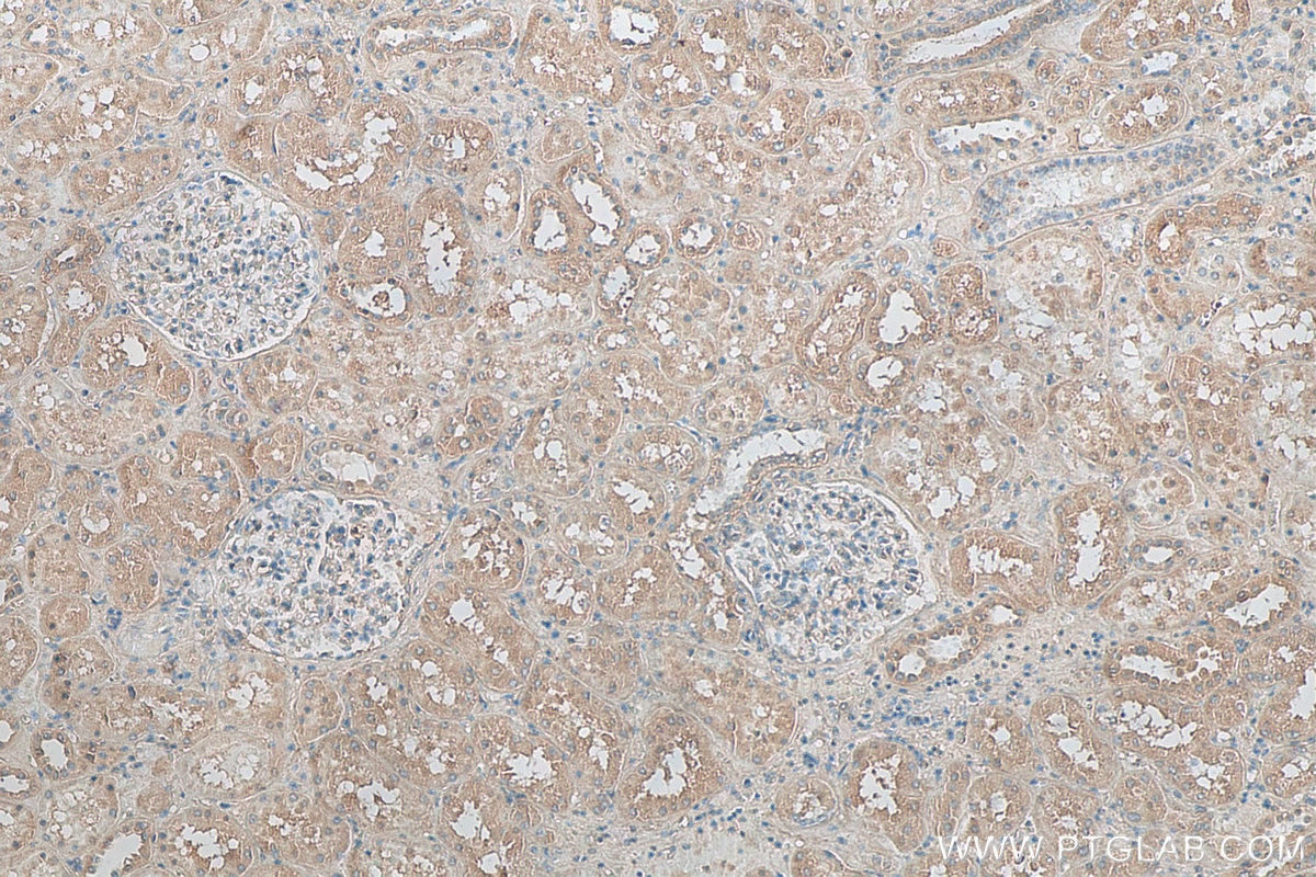 Immunohistochemistry (IHC) staining of human kidney tissue using NLRP3 Monoclonal antibody (68102-1-Ig)