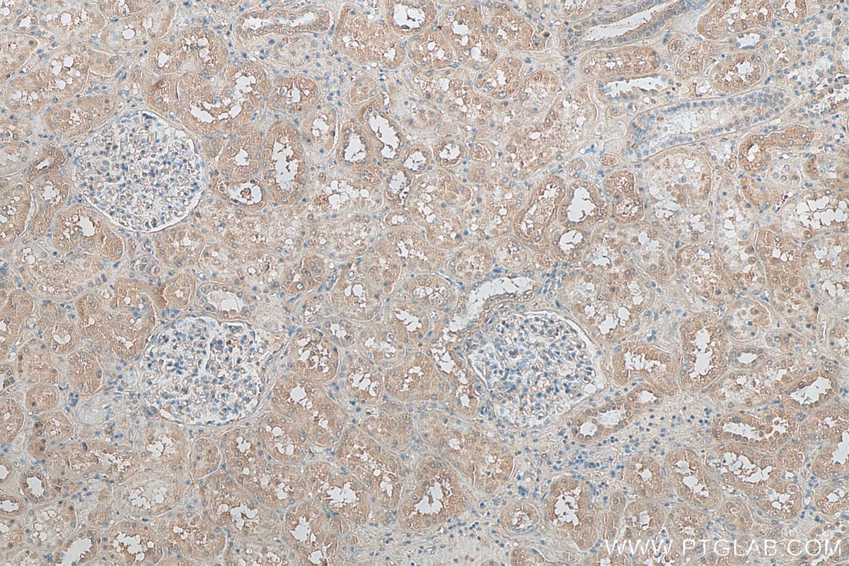 IHC staining of human kidney using 68102-1-Ig