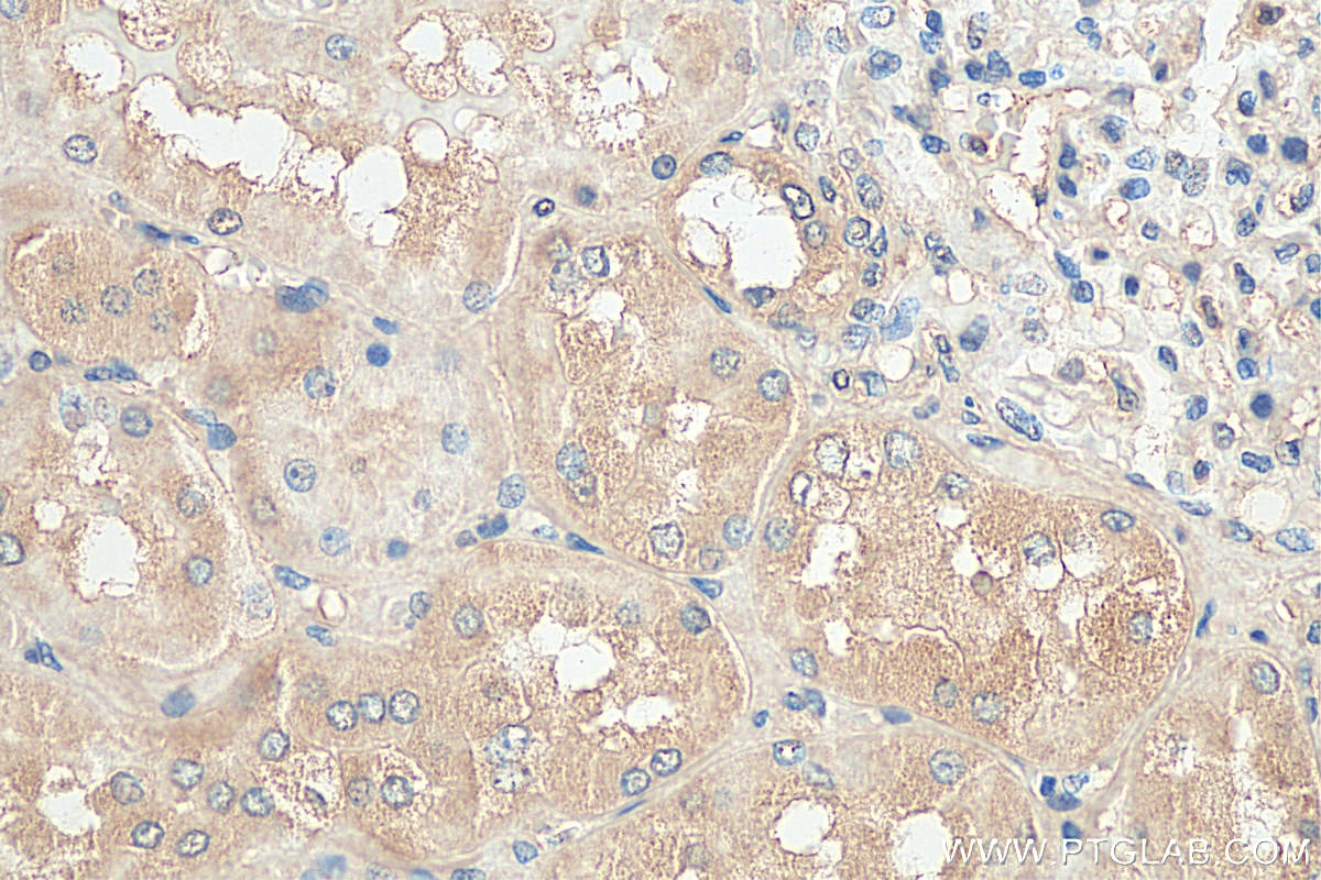 Immunohistochemistry (IHC) staining of human kidney tissue using NLRP3 Monoclonal antibody (68102-1-Ig)