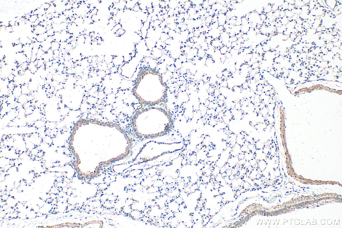 IHC staining of mouse lung using 32694-1-AP (same clone as 32694-1-PBS) Immunohistochemistry (IHC) staining of mouse lung tissue using NLRP4 Polyclonal antibody (32694-1-AP)