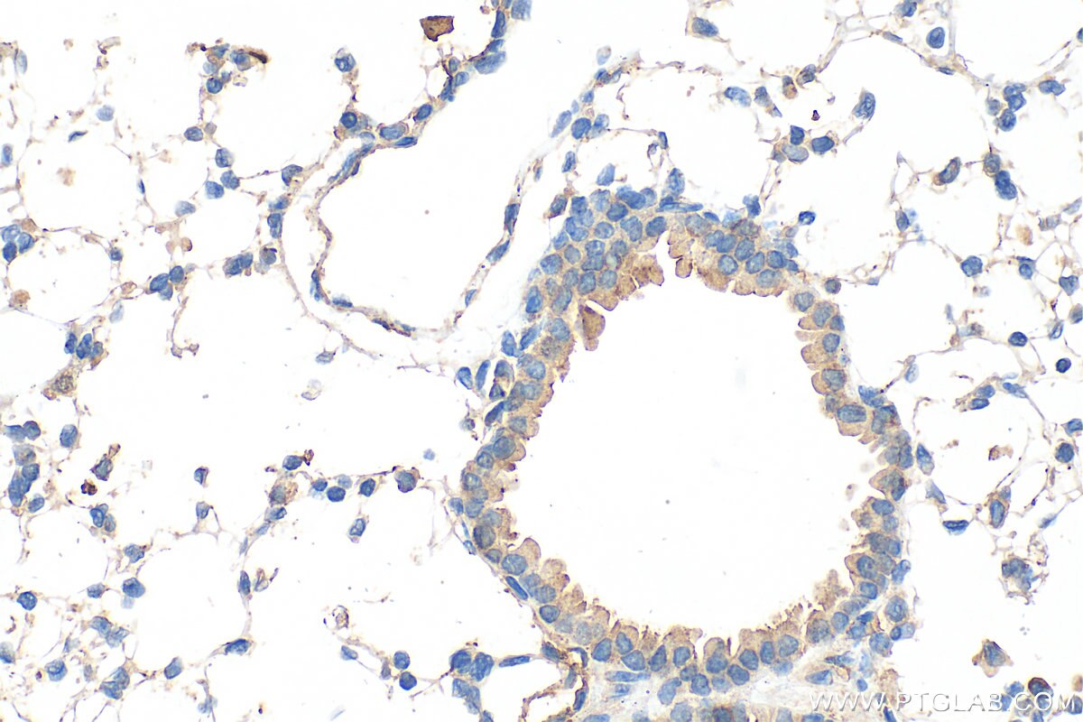 IHC staining of mouse lung using 32694-1-AP (same clone as 32694-1-PBS) Immunohistochemistry (IHC) staining of mouse lung tissue using NLRP4 Polyclonal antibody (32694-1-AP)
