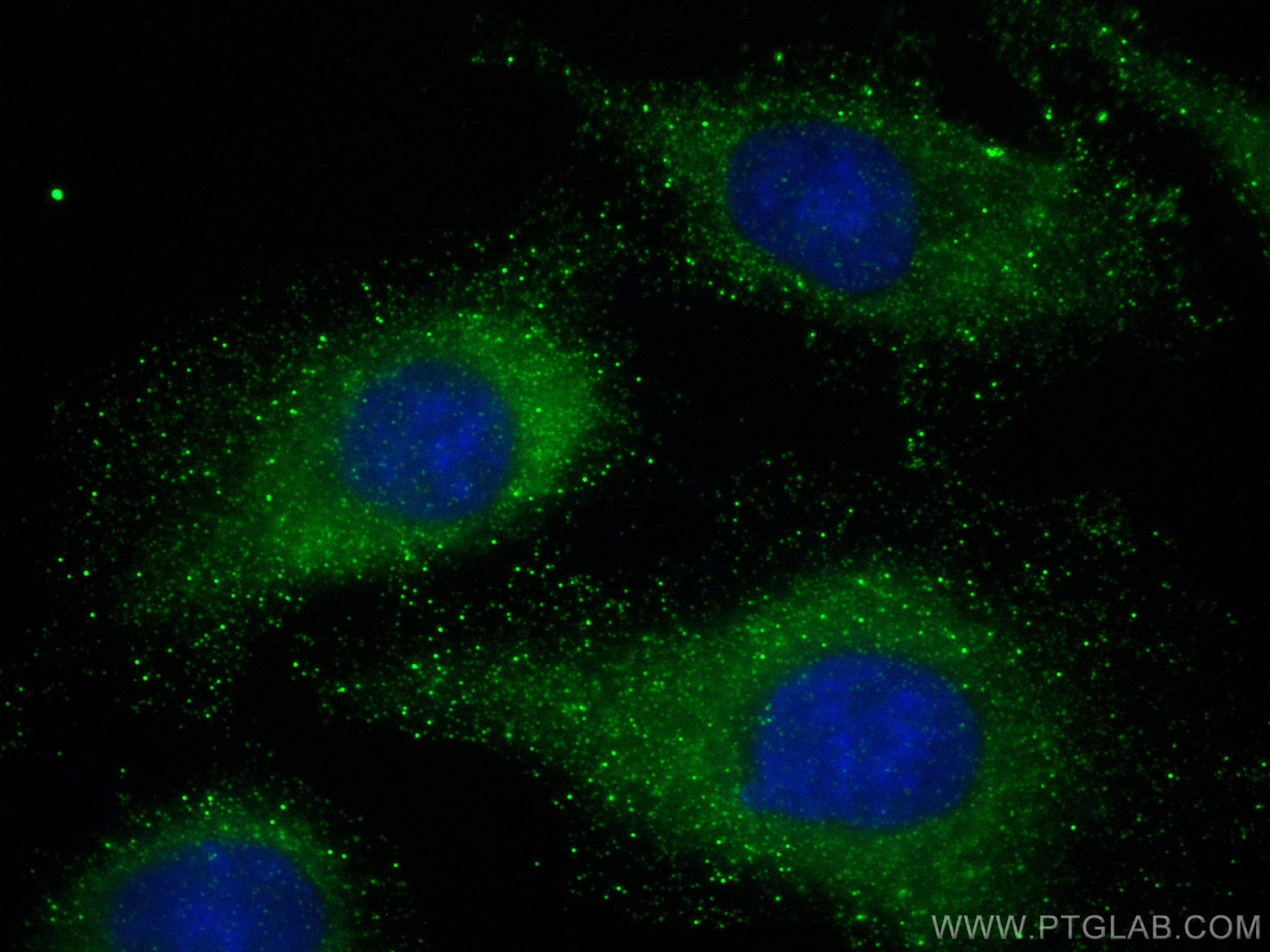 Immunofluorescence (IF) / fluorescent staining of A549 cells using NLRP6 Recombinant antibody (83555-5-RR)