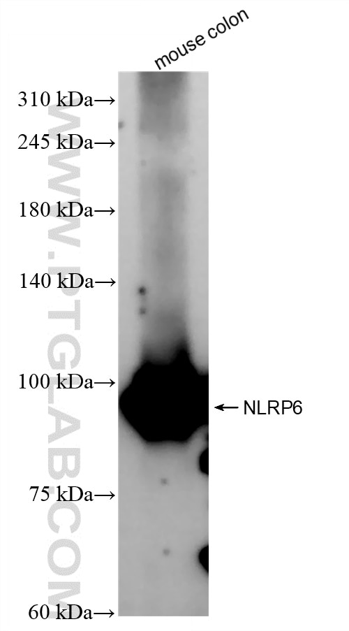 Western Blot (WB) analysis of mouse colon tissue using NLRP6 Recombinant antibody (83555-5-RR)