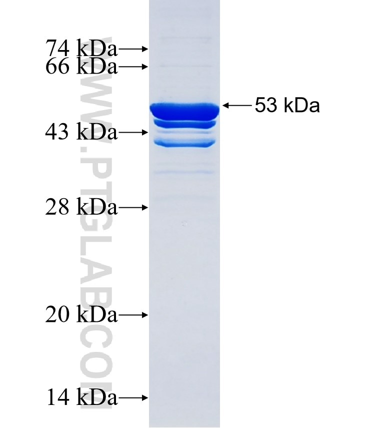 NLRP6 fusion protein Ag34516 SDS-PAGE